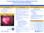 Inverted Appendix Presenting As Abdominal Pain And Lower Gastrointestinal Bleeding