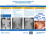 Endoscopic Removal of Safety Pin from Appendiceal Orifice by Alex Biller, Moises Alatorre-Jimenez, Jeremy Stewart, and Ruba A. Abdelhadi