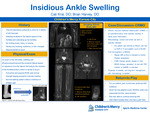 Insidious Ankle Swelling