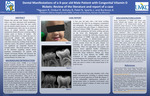 Dental Manifestations of a 4-year old Male Patient with Congenital Vitamin D Rickets: Review of the Literature and Report of a Case by Richard Nguyen, Robin Onikul, Brenda S. Bohaty, Neena Patel, Jenna Sparks, and Amy Burleson