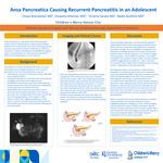 A Case Report: Ansa Pancreatica as a Cause of Recurrent Pancreatitis by Chase Branstetter, Elizaveta Khenner, Victoria Sarata, and Nadia Ibrahimi