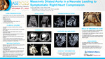 Massively Dilated Aorta in a Neonate Leading to Symptomatic Right Heart Compression by Lauren Littell and Peter LaRossa