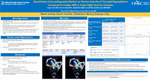 Quantitative Echocardiography Markers to Denote Severity of Tricuspid Regurgitation Compared to Cardiac MRI in Single Right Ventricle Variants by Tony Zunica, Daniel Forsha, Janelle Noel-Macdonnell, and Anmol Goyal