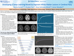 Developing a Deep-Learning Model to Segment White Matter Lesions in Cerebral Palsy
